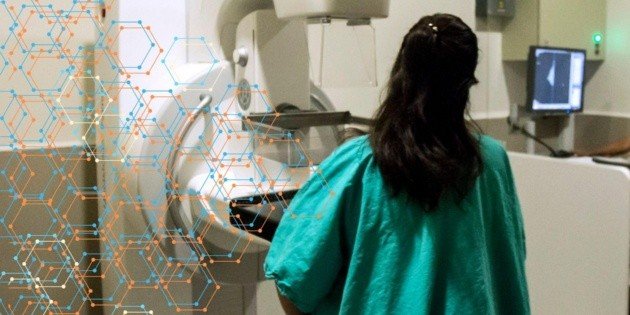 IA Revoluciona Diagnósticos de Cáncer de Mama en Jalisco