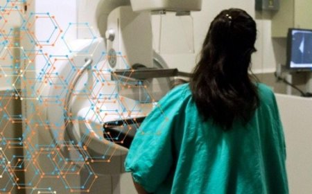 IA Revoluciona Diagnósticos de Cáncer de Mama en Jalisco